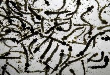 Presencia en África de misma cepa de Zika que afecta a Brasil