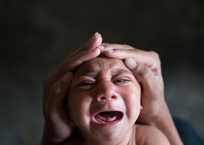 ZIKA
