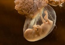 Ley obliga a médicos a anestesiar a fetos antes de un aborto