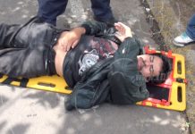 Accidente lo deja con la pierna fracturada