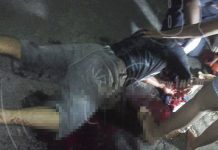 Machetazo lo tiene entre la vida y la muerte