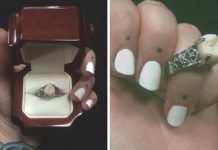 Insólito: Recibió un anillo de compromiso con una muela