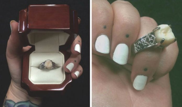 anillo-muela-del-juicio-1