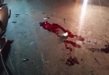Estelí: Par de accidentes por querer aventajar