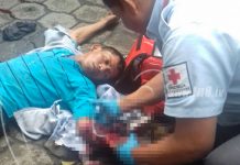 Grave tras pasarle bus en el brazo