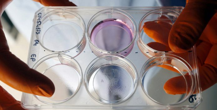 bacteria
