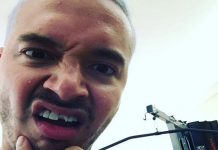 ¡Qué escándalo J Balvin se quebró el diente!