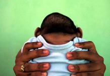 El Salvador: Confirman primer caso de microcefalia