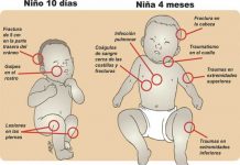 Costa Rica: Bestia de Alajuelita mata 2 hijos recién nacidos
