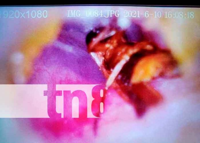 Nicaragua, bluefields, niño, animal, oído,