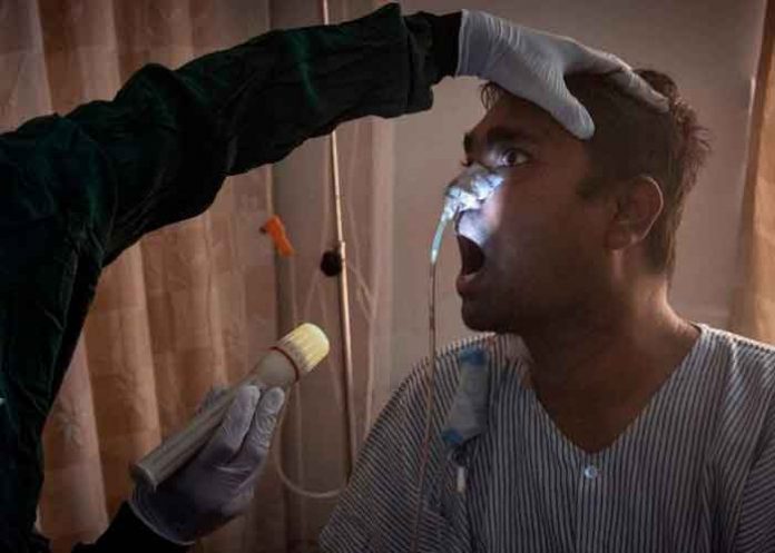 brasil, contagio, hongo negro, covid, pandemia,