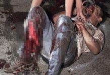 Trágico accidente deja a un motociclista sin una de sus piernas (Video)