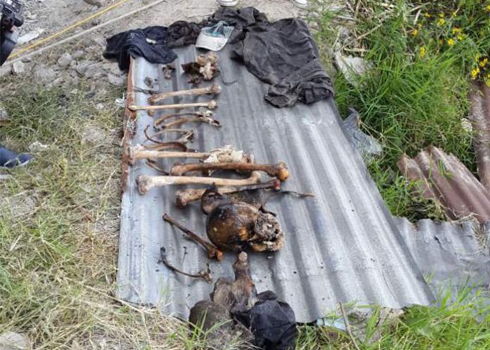 cadaver2