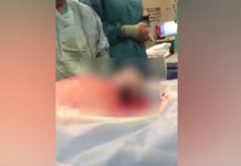 Impresionante nacimiento de un bebé por cesárea se vuelve viral