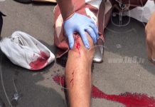 Ciclista sufre grave accidente