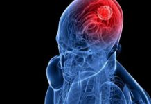 Descubren tratamiento para personas en coma