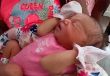 EE.UU: Cortan la cara de una bebé durante una cesárea de emergencia estados unidos, bebe, cirugia, negligencia,