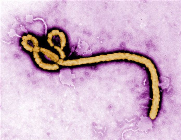 ebolasobre