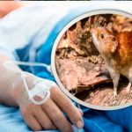 Estados unidos, Míchigan, hantavirus, humano, primer caso,