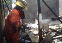 Chinandega: Menor termina con quemaduras tras incendio