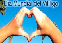 25 de junio: Día Mundial del vitíligo Vitiligo, diagnóstico, tratamiento, enfermedad,