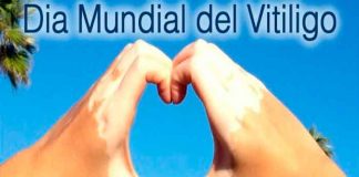 Vitiligo, diagnóstico, tratamiento, enfermedad,
