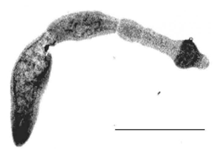 canada, cientificos, enfermedad, higado,