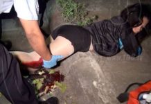 Pareja de motociclistas resulta gravemente herida en accidente