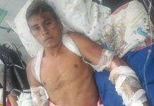Honduras: Héroe que salvó a niña en incendio urge ayuda