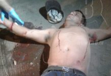 Managua: Hombre se intenta de cortar los pulsos