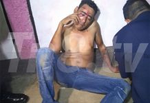 Persona resulta heridas en la cabeza al caer en plena calle