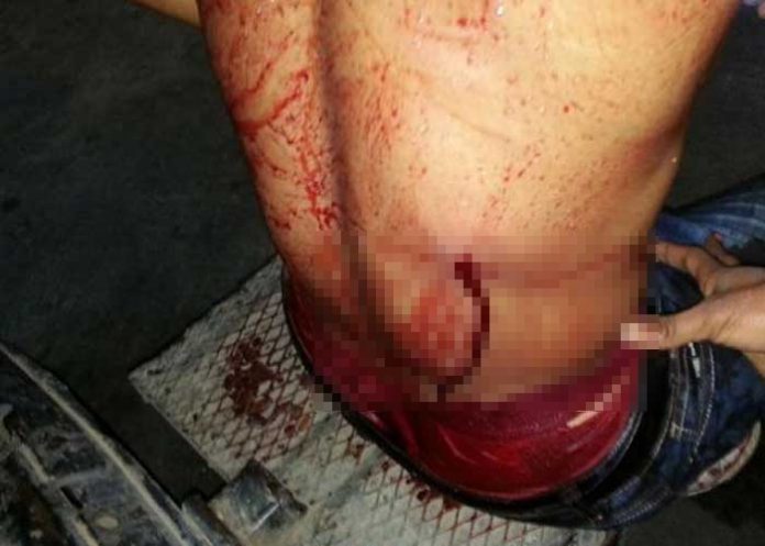 herido-bb
