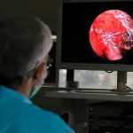 India , congo negro, síntomas, salud,