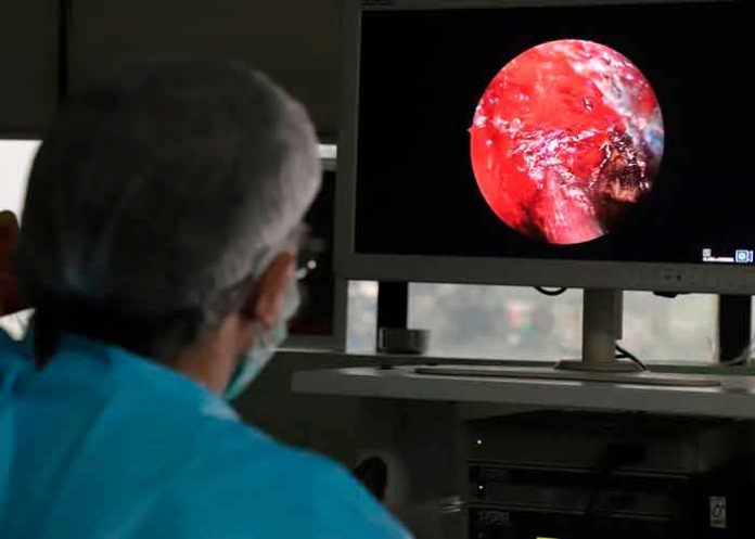 India , congo negro, síntomas, salud,