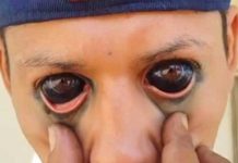 Hondureño se tatúa los ojos tras ver programa Tabú