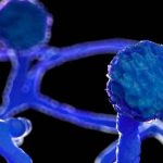 Se detectó en México el primer caso del hongo negro mexico, deteccion, hongo negro, enfermedad, salud,