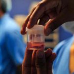 Honduras confirma primer caso de hongo negro en paciente recuperado de covid honduras, paciente, hongo negro, enfermedades,