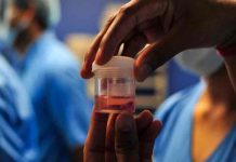 Honduras confirma primer caso de hongo negro en paciente recuperado de covid honduras, paciente, hongo negro, enfermedades,