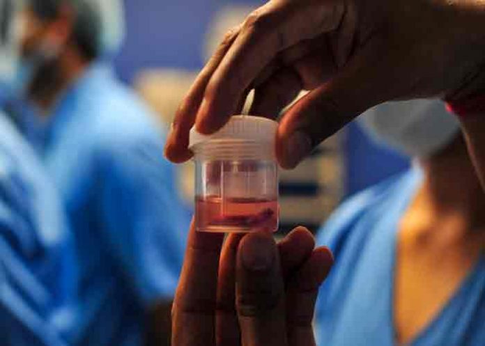 hongo-honduras honduras, paciente, hongo negro, enfermedades,