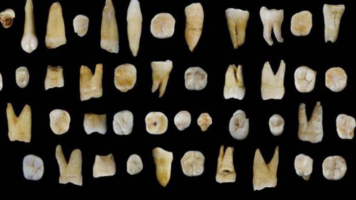 humanteeth1