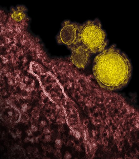 ARABIA SAUDI-VIRUS