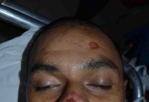 Ganó la pelea pero perdió la vida