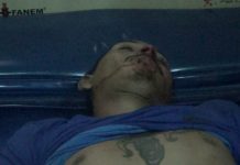 Pierde la vida al estrellarse contra dos montados
