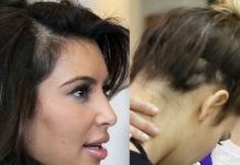 Kim Kardashian se está quedando calva