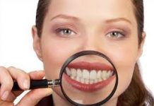 Opciones para quitar las manchas de los dientes