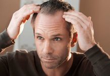 Cómo disimular las entradas del pelo