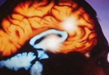 La resistencia del cerebro al estrés sirve para prevenir el alzhéimer y la demencia