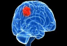 Descubren molécula que revierte el crecimiento de tumores cerebrales