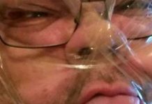 «Selfies» con cinta adhesiva, la nueva tendencia de la web
