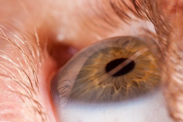 images_SECCIONES_PAGINA_WEB_ULTIMA_HORA_2014_FEBRERO_DEL_17_AL_23_629-desprendimiento_de_retina